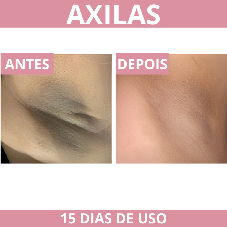 PROVA SOCIAL CICA AXILAS