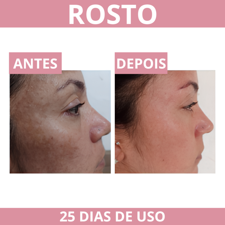 PROVA SOCIAL CICA ROSTO