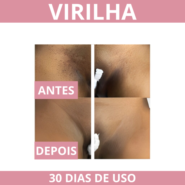 PROVA SOCIAL CICA VIRILHA